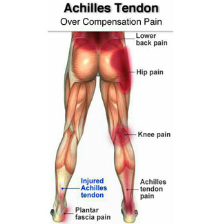 Knee pain and hotsell achilles tendon